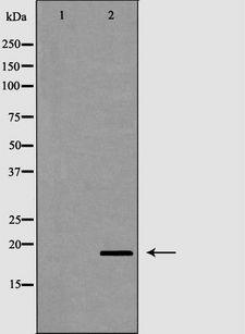 PTN / Pleiotrophin Antibody - Western blot analysis of extracts of human colon carcinoma using PTN antibody. The lane on the left is treated with the antigen-specific peptide.