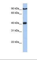 PTOV1 Antibody - Jurkat cell lysate. Antibody concentration: 1.0 ug/ml. Gel concentration: 12%.  This image was taken for the unconjugated form of this product. Other forms have not been tested.