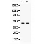 PTOV1 Antibody - PTOV1 antibody Western blot. All lanes: Anti PTOV1 at 0.5 ug/ml. Lane 1: Rat Brain Tissue Lysate at 50 ug. Lane 2: Rat Kidney Tissue Lysate at 50 ug. Predicted band size: 47 kD. Observed band size: 47 kD.