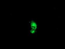 PTP1B Antibody - Anti-PTPN1 mouse monoclonal antibody immunofluorescent staining of COS7 cells transiently transfected by pCMV6-ENTRY PTPN1.