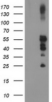 PTP1B Antibody - HEK293T cells were transfected with the pCMV6-ENTRY control (Left lane) or pCMV6-ENTRY PTPN1 (Right lane) cDNA for 48 hrs and lysed. Equivalent amounts of cell lysates (5 ug per lane) were separated by SDS-PAGE and immunoblotted with anti-PTPN1.