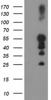 PTP1B Antibody - HEK293T cells were transfected with the pCMV6-ENTRY control (Left lane) or pCMV6-ENTRY PTPN1 (Right lane) cDNA for 48 hrs and lysed. Equivalent amounts of cell lysates (5 ug per lane) were separated by SDS-PAGE and immunoblotted with anti-PTPN1.