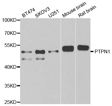PTP1B Antibody - Western blot analysis of extracts of various cell lines, using PTPN1 antibody at 1:1000 dilution. The secondary antibody used was an HRP Goat Anti-Rabbit IgG (H+L) at 1:10000 dilution. Lysates were loaded 25ug per lane and 3% nonfat dry milk in TBST was used for blocking. An ECL Kit was used for detection and the exposure time was 90s.