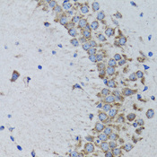 PTP1B Antibody - Immunohistochemistry of paraffin-embedded rat brain using PTPN1 antibodyat dilution of 1:100 (40x lens).