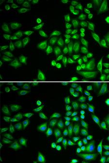 PTP1B Antibody - Immunofluorescence analysis of MCF-7 cells using PTPN1 antibody. Blue: DAPI for nuclear staining.