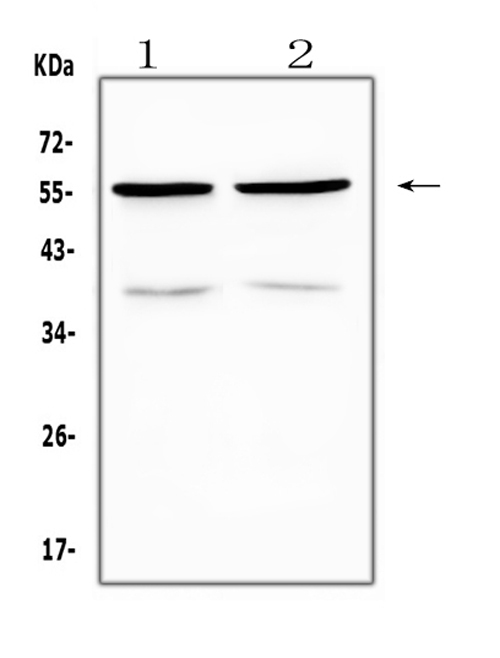 PTP1B Antibody - Western blot analysis of PTP1B using anti-PTP1B antibody. Electrophoresis was performed on a 5-20% SDS-PAGE gel at 70V (Stacking gel) / 90V (Resolving gel) for 2-3 hours. The sample well of each lane was loaded with 50ug of sample under reducing conditions. Lane 1: rat kidney tissue lysate,Lane 2: mouse kidney tissue lysate. After Electrophoresis, proteins were transferred to a Nitrocellulose membrane at 150mA for 50-90 minutes. Blocked the membrane with 5% Non-fat Milk/ TBS for 1.5 hour at RT. The membrane was incubated with rabbit anti-PTP1B antigen affinity purified polyclonal antibody at 0.5 µg/mL overnight at 4°C, then washed with TBS-0.1% Tween 3 times with 5 minutes each and probed with a goat anti-rabbit IgG-HRP secondary antibody at a dilution of 1:10000 for 1.5 hour at RT. The signal is developed using an Enhanced Chemiluminescent detection (ECL) kit with Tanon 5200 system. A specific band was detected for PTP1B at approximately 57KD. The expected band size for PTP1B is at 50KD.