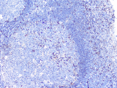 PTP1B Antibody - IHC analysis of PTP1B using anti-PTP1B antibody. PTP1B was detected in paraffin-embedded section of human tonsil tissues. Heat mediated antigen retrieval was performed in citrate buffer (pH6, epitope retrieval solution) for 20 mins. The tissue section was blocked with 10% goat serum. The tissue section was then incubated with 1µg/ml rabbit anti-PTP1B Antibody overnight at 4°C. Biotinylated goat anti-rabbit IgG was used as secondary antibody and incubated for 30 minutes at 37°C. The tissue section was developed using Strepavidin-Biotin-Complex (SABC) with DAB as the chromogen.