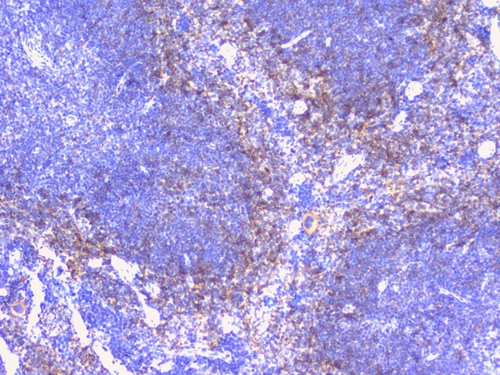 PTP1B Antibody - IHC analysis of PTP1B using anti-PTP1B antibody. PTP1B was detected in paraffin-embedded section of mouse spleen tissues. Heat mediated antigen retrieval was performed in citrate buffer (pH6, epitope retrieval solution) for 20 mins. The tissue section was blocked with 10% goat serum. The tissue section was then incubated with 1µg/ml rabbit anti-PTP1B Antibody overnight at 4°C. Biotinylated goat anti-rabbit IgG was used as secondary antibody and incubated for 30 minutes at 37°C. The tissue section was developed using Strepavidin-Biotin-Complex (SABC) with DAB as the chromogen.
