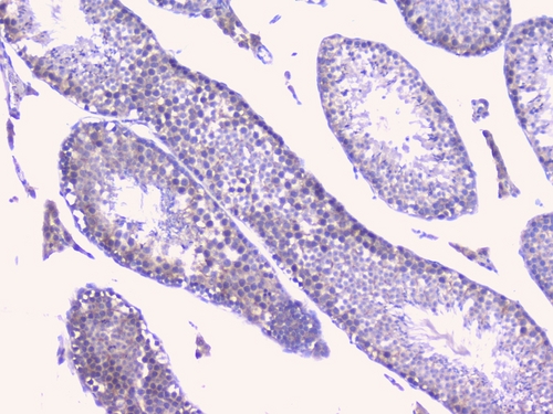 PTP1B Antibody - IHC analysis of PTP1B using anti-PTP1B antibody. PTP1B was detected in paraffin-embedded section of mouse testis tissues. Heat mediated antigen retrieval was performed in citrate buffer (pH6, epitope retrieval solution) for 20 mins. The tissue section was blocked with 10% goat serum. The tissue section was then incubated with 1µg/ml rabbit anti-PTP1B Antibody overnight at 4°C. Biotinylated goat anti-rabbit IgG was used as secondary antibody and incubated for 30 minutes at 37°C. The tissue section was developed using Strepavidin-Biotin-Complex (SABC) with DAB as the chromogen.