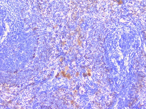 PTP1B Antibody - IHC analysis of PTP1B using anti-PTP1B antibody. PTP1B was detected in paraffin-embedded section of rat spleen tissues. Heat mediated antigen retrieval was performed in citrate buffer (pH6, epitope retrieval solution) for 20 mins. The tissue section was blocked with 10% goat serum. The tissue section was then incubated with 1µg/ml rabbit anti-PTP1B Antibody overnight at 4°C. Biotinylated goat anti-rabbit IgG was used as secondary antibody and incubated for 30 minutes at 37°C. The tissue section was developed using Strepavidin-Biotin-Complex (SABC) with DAB as the chromogen.
