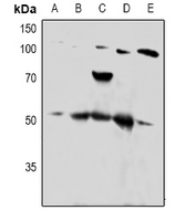 PTP1B Antibody - Western blot analysis of PTP1B expression in HepG2 (A), MCF7 (B), A549 (C), HEK293T (D), mouse lung (E) whole cell lysates.