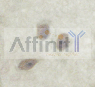 PTP1B Antibody - 1/100 staining human brain tissue by IHC-P. The sample was formaldehyde fixed and a heat mediated antigen retrieval step in citrate buffer was performed. The sample was then blocked and incubated with the antibody for 1.5 hours at 22°C. An HRP conjugated goat anti-rabbit antibody was used as the secondary antibody.