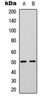 PTP1B Antibody - Western blot analysis of PTP1B expression in HeLa (A); Jurkat (B) whole cell lysates.