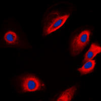 PTP1B Antibody - Immunofluorescent analysis of PTP1B staining in SKNSH cells. Formalin-fixed cells were permeabilized with 0.1% Triton X-100 in TBS for 5-10 minutes and blocked with 3% BSA-PBS for 30 minutes at room temperature. Cells were probed with the primary antibody in 3% BSA-PBS and incubated overnight at 4 deg C in a humidified chamber. Cells were washed with PBST and incubated with a DyLight 594-conjugated secondary antibody (red) in PBS at room temperature in the dark. DAPI was used to stain the cell nuclei (blue).