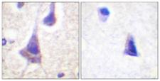 PTP1B Antibody - Peptide - + Immunohistochemistry analysis of paraffin-embedded human brain tissue using PTP1B (Ab-50) antibody.