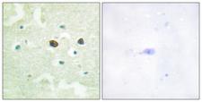 PTP1B Antibody - Immunohistochemistry analysis of paraffin-embedded human brain, using PTP1B (Phospho-Ser50) Antibody. The picture on the right is blocked with the phospho peptide.