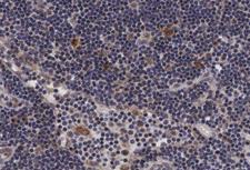 PTP1B Antibody - 1:200 staining human lymph nodes tissue by IHC-P. The tissue was formaldehyde fixed and a heat mediated antigen retrieval step in citrate buffer was performed. The tissue was then blocked and incubated with the antibody for 1.5 hours at 22°C. An HRP conjugated goat anti-rabbit antibody was used as the secondary.
