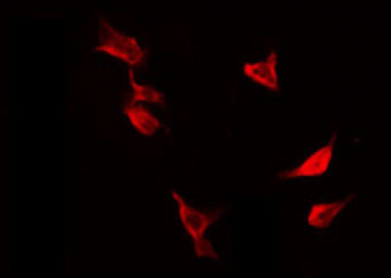 PTP1B Antibody - Staining HeLa cells by IF/ICC. The samples were fixed with PFA and permeabilized in 0.1% Triton X-100, then blocked in 10% serum for 45 min at 25°C. The primary antibody was diluted at 1:200 and incubated with the sample for 1 hour at 37°C. An Alexa Fluor 594 conjugated goat anti-rabbit IgG (H+L) Ab, diluted at 1/600, was used as the secondary antibody.
