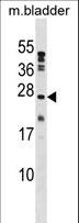 PTP4A1 / PRL-1 Antibody - PTP4A1 Antibody western blot of mouse bladder tissue lysates (35 ug/lane). The PTP4A1 antibody detected the PTP4A1 protein (arrow).