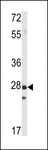 PTP4A1 / PRL-1 Antibody - Western blot of PRL1 in mouse spleen tissue lysates (35 ug/lane). PRL1 Antibody (arrow) was detected using the purified antibody.