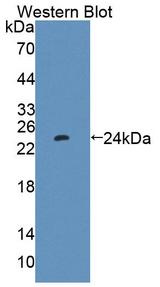 PTP4A1 / PRL-1 Antibody - Western Blot; Sample: Recombinant protein.