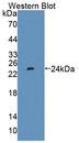 PTP4A1 / PRL-1 Antibody - Western Blot; Sample: Recombinant protein.