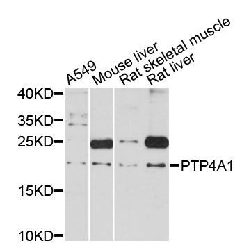 PTP4A1 / PRL-1 Antibody - Western blot analysis of extracts of various cell lines, using PTP4A1 antibody at 1:3000 dilution. The secondary antibody used was an HRP Goat Anti-Rabbit IgG (H+L) at 1:10000 dilution. Lysates were loaded 25ug per lane and 3% nonfat dry milk in TBST was used for blocking. An ECL Kit was used for detection and the exposure time was 90s.
