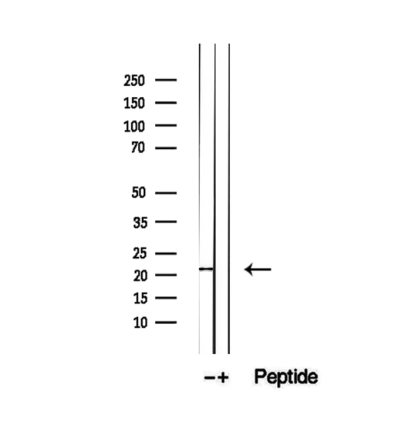 PTP4A1 / PRL-1 Antibody - Western blot analysis of extracts of MCF-7 cells using PTP4A1/PRL1 antibody.