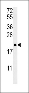PTP4A2 / PRL-2 Antibody - PTP4A2 Antibody western blot of NCI-H460 cell line lysates (35 ug/lane). The PTP4A2 antibody detected the PTP4A2 protein (arrow).