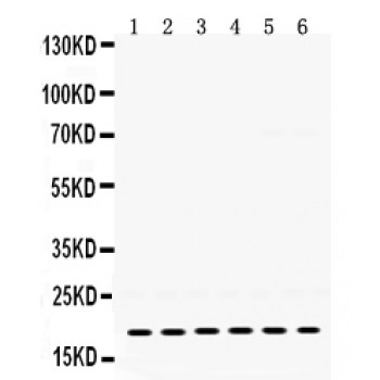 PTP4A2 / PRL-2 Antibody - PTP4A2 antibody Western blot. All lanes: Anti PTP4A2 at 0.5 ug/ml. Lane 1: Rat Skeletal Muscle Tissue Lysate at 50 ug. Lane 2: Rat Thymus Tissue Lysate at 50 ug. Lane 3: Mouse Brain Tissue Lysate at 50 ug. Lane 4: Mouse Thymus Tissue Lysate at 50 ug. Lane 5: 22RV1 Whole Cell Lysate at 40 ug. Lane 6: MCF-7 Whole Cell Lysate at 40 ug. Predicted band size: 19 kD. Observed band size: 19 kD.