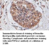 PTP4A2 / PRL-2 Antibody