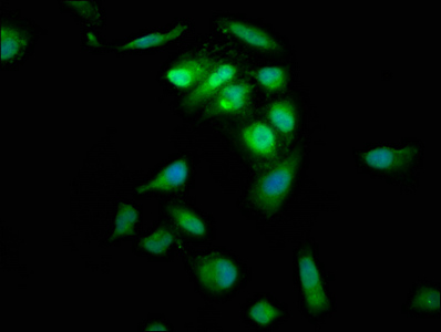 PTP4A2 / PRL-2 Antibody - Immunofluorescence staining of Hela cells at a dilution of 1:66, counter-stained with DAPI. The cells were fixed in 4% formaldehyde, permeabilized using 0.2% Triton X-100 and blocked in 10% normal Goat Serum. The cells were then incubated with the antibody overnight at 4 °C.The secondary antibody was Alexa Fluor 488-congugated AffiniPure Goat Anti-Rabbit IgG (H+L) .