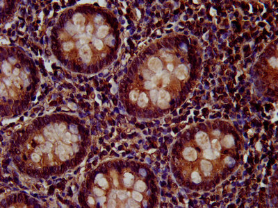 PTP4A2 / PRL-2 Antibody - Immunohistochemistry image at a dilution of 1:200 and staining in paraffin-embedded human appendix tissue performed on a Leica BondTM system. After dewaxing and hydration, antigen retrieval was mediated by high pressure in a citrate buffer (pH 6.0) . Section was blocked with 10% normal goat serum 30min at RT. Then primary antibody (1% BSA) was incubated at 4 °C overnight. The primary is detected by a biotinylated secondary antibody and visualized using an HRP conjugated SP system.
