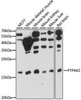 PTP4A2 / PRL-2 Antibody - Western blot analysis of extracts of various cell lines, using PTP4A2 antibody at 1:1000 dilution. The secondary antibody used was an HRP Goat Anti-Rabbit IgG (H+L) at 1:10000 dilution. Lysates were loaded 25ug per lane and 3% nonfat dry milk in TBST was used for blocking. An ECL Kit was used for detection and the exposure time was 30s.