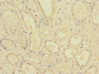 PTPMEG / PTPN4 Antibody - Immunohistochemistry of paraffin-embedded human kidney tissue at dilution 1:100