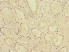 PTPMEG / PTPN4 Antibody - Immunohistochemistry of paraffin-embedded human kidney tissue at dilution 1:100