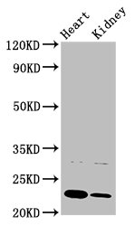 PTPMT1 Antibody - Western Blot Positive WB detected in: Rat heart tisue, Rat kidney tissue All lanes: PTPMT1 antibody at 3µg/ml Secondary Goat polyclonal to rabbit IgG at 1/50000 dilution Predicted band size: 23, 16, 17 kDa Observed band size: 23 kDa