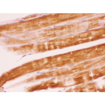PTPN11 / SHP-2 / NS1 Antibody - SHP2 antibody IHC-paraffin. IHC(P): Rat Skeletal Muscle Tissue.