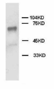 PTPN11 / SHP-2 / NS1 Antibody -  This image was taken for the unconjugated form of this product. Other forms have not been tested.
