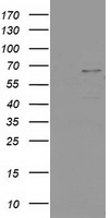 PTPN11 / SHP-2 / NS1 Antibody - HEK293T cells were transfected with the pCMV6-ENTRY control (Left lane) or pCMV6-ENTRY PTPN11 (Right lane) cDNA for 48 hrs and lysed. Equivalent amounts of cell lysates (5 ug per lane) were separated by SDS-PAGE and immunoblotted with anti-PTPN11.