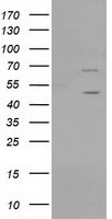 PTPN11 / SHP-2 / NS1 Antibody - HEK293T cells were transfected with the pCMV6-ENTRY control (Left lane) or pCMV6-ENTRY PTPN11 (Right lane) cDNA for 48 hrs and lysed. Equivalent amounts of cell lysates (5 ug per lane) were separated by SDS-PAGE and immunoblotted with anti-PTPN11.
