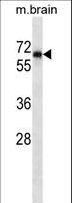 PTPN11 / SHP-2 / NS1 Antibody - PTPN11 Antibody western blot of mouse brian tissue lysates (35 ug/lane). The PTPN11 antibody detected the PTPN11 protein (arrow).