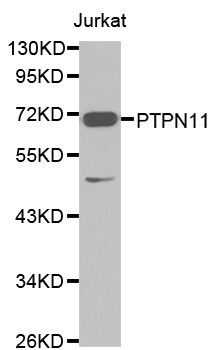 PTPN11 / SHP-2 / NS1 Antibody - Western blot analysis of extracts of Jurkat cells, using PTPN11 antibody. The secondary antibody used was an HRP Goat Anti-Rabbit IgG (H+L) at 1:10000 dilution. Lysates were loaded 25ug per lane and 3% nonfat dry milk in TBST was used for blocking.
