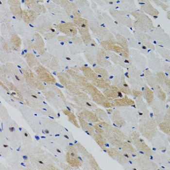 PTPN11 / SHP-2 / NS1 Antibody - Immunohistochemistry of paraffin-embedded rat heart tissue.