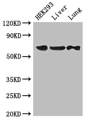 PTPN11 / SHP-2 / NS1 Antibody - Positive WB detected in:HEK293 whole cell lysate,Mouse liver tissue,Mouse lung tissue;All lanes:PTPN11 antibody at 2.8ug/ml;Secondary;Goat polyclonal to rabbit IgG at 1/50000 dilution;Predicted band size: 69,53 kDa;Observed band size: 69 kDa;