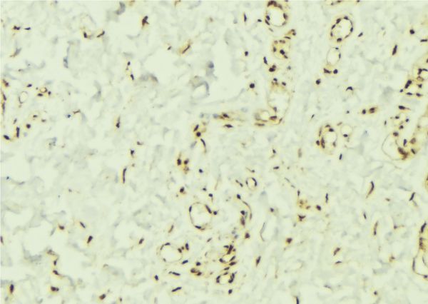 PTPN11 / SHP-2 / NS1 Antibody - 1:100 staining mouse muscle tissue by IHC-P. The sample was formaldehyde fixed and a heat mediated antigen retrieval step in citrate buffer was performed. The sample was then blocked and incubated with the antibody for 1.5 hours at 22°C. An HRP conjugated goat anti-rabbit antibody was used as the secondary.