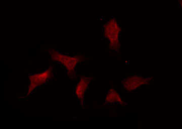 PTPN11 / SHP-2 / NS1 Antibody - Staining A431 cells by IF/ICC. The samples were fixed with PFA and permeabilized in 0.1% Triton X-100, then blocked in 10% serum for 45 min at 25°C. The primary antibody was diluted at 1:200 and incubated with the sample for 1 hour at 37°C. An Alexa Fluor 594 conjugated goat anti-rabbit IgG (H+L) Ab, diluted at 1/600, was used as the secondary antibody.