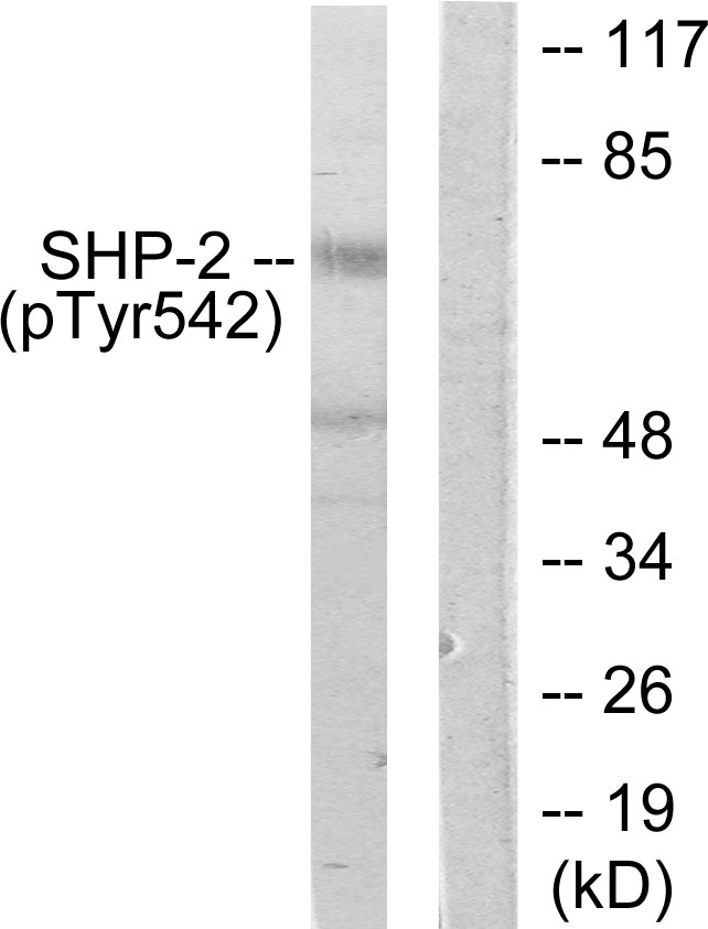 PTPN11 / SHP-2 / NS1 Antibody - Western blot analysis of lysates from A431 cells, using SHP-2 (Phospho-Tyr542) Antibody. The lane on the right is blocked with the phospho peptide.