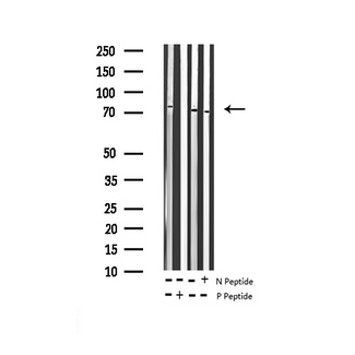 PTPN11 / SHP-2 / NS1 Antibody - Western blot analysis of Phospho-SHP-2 (Tyr542) expression in various lysates