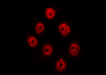 PTPN11 / SHP-2 / NS1 Antibody - Staining A431 cells by IF/ICC. The samples were fixed with PFA and permeabilized in 0.1% Triton X-100, then blocked in 10% serum for 45 min at 25°C. The primary antibody was diluted at 1:200 and incubated with the sample for 1 hour at 37°C. An Alexa Fluor 594 conjugated goat anti-rabbit IgG (H+L) Ab, diluted at 1/600, was used as the secondary antibody.